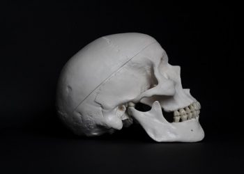 Identificación mediante comparativa morfo geométrica y euclidiana aplicada sobre tacs craneales de origen ante y postmortem