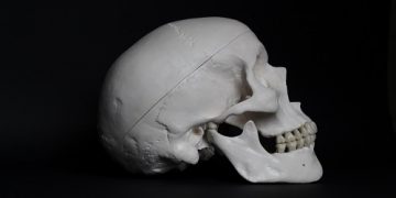 Identificación mediante comparativa morfo geométrica y euclidiana aplicada sobre tacs craneales de origen ante y postmortem