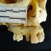 Lesión facial y valor identificativo en un diente