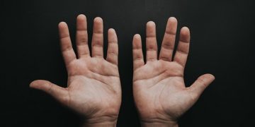 Patología de Muñeca y Mano en el Ámbito Laboral