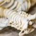 Bucles vasculares en segmento V2 de la arteria vertebral como hallazgo no tan infrecuente