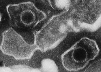 Fatal Epstein-Barr virus infection in an immunocomptent host: a postmortem diagnosis