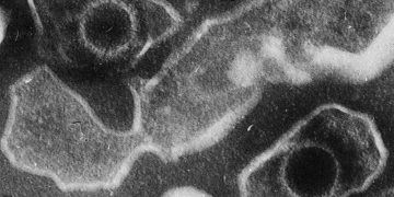 Fatal Epstein-Barr virus infection in an immunocomptent host: a postmortem diagnosis