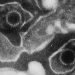 Fatal Epstein-Barr virus infection in an immunocomptent host: a postmortem diagnosis